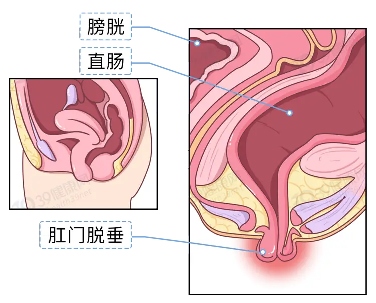 拼多多爆款运营怎么做？_拼多多运营全攻略_拼多多运营干货